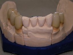 Unterkiefer von vorne