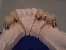 Unterkiefer von innen