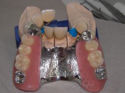 Oberkiefer in Aufsicht