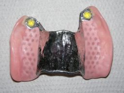 OK-Unterseite mit Druckkn�pfen