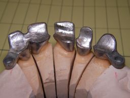 Oberkiefer von innen