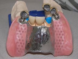 Oberkiefer von Unterseite