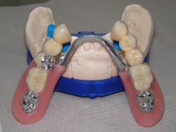 Unterkiefer in Aufsicht