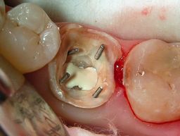 Aufbaufüllung in Arbeit, andere Perspektive