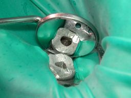 Zugangskavität mit Spiegel, Übersicht