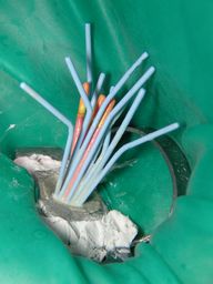 Endodontie-Feilen zur Arbeitslängenbestimmung