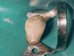 Fertiger Kompositaufbau, Seitenansicht