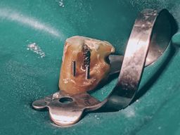 Parapost und Schraubenstifte vor dem Aufbau