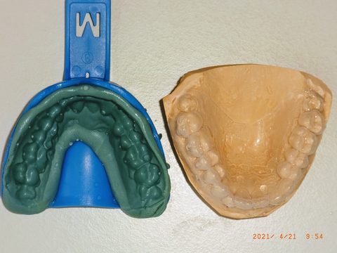 KIL fertig neben Gipsmodell, Übersicht