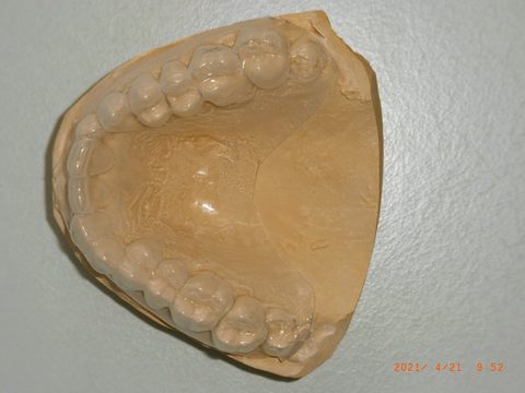 Gipsmodell mit Tiefziehfolie